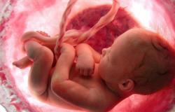 Когда появляются ядра окостенения тазобедренных суставов у новорожденных?